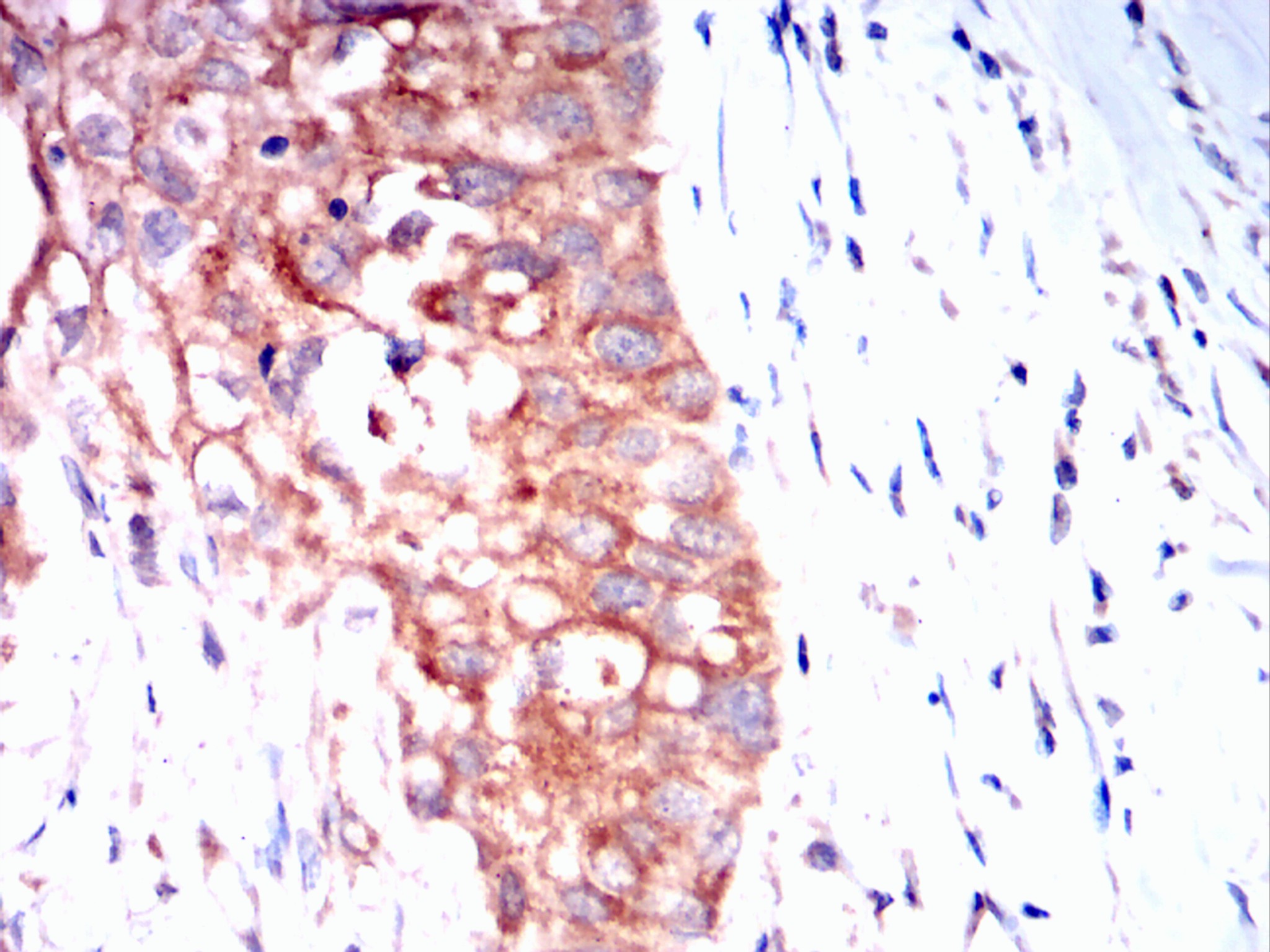 		IHC